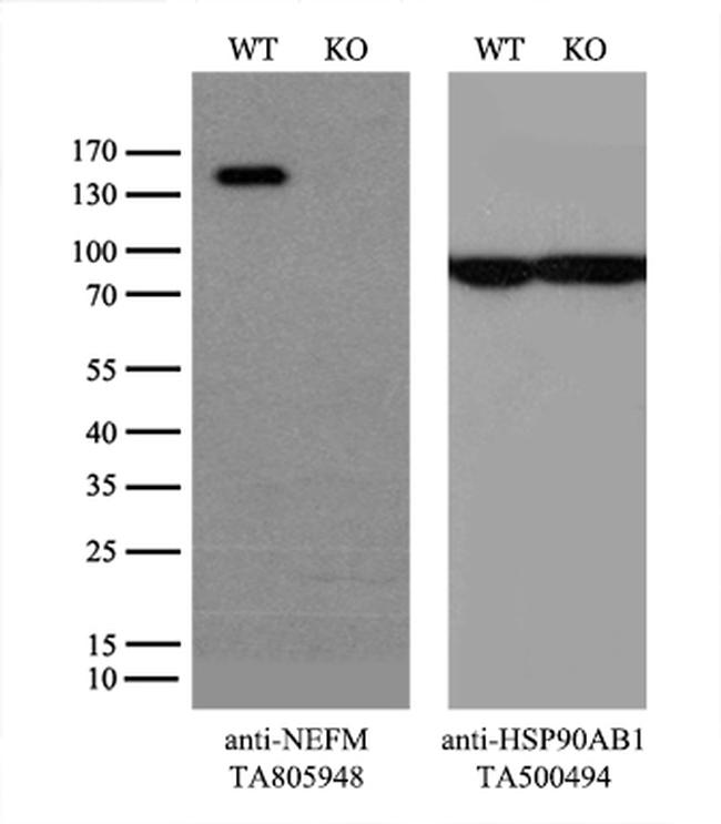 NEFM Antibody in Western Blot (WB)