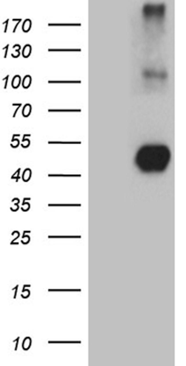 NEGR1 Antibody in Western Blot (WB)