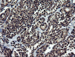 NEK11 Antibody in Immunohistochemistry (Paraffin) (IHC (P))