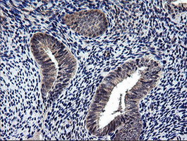 NEK11 Antibody in Immunohistochemistry (Paraffin) (IHC (P))