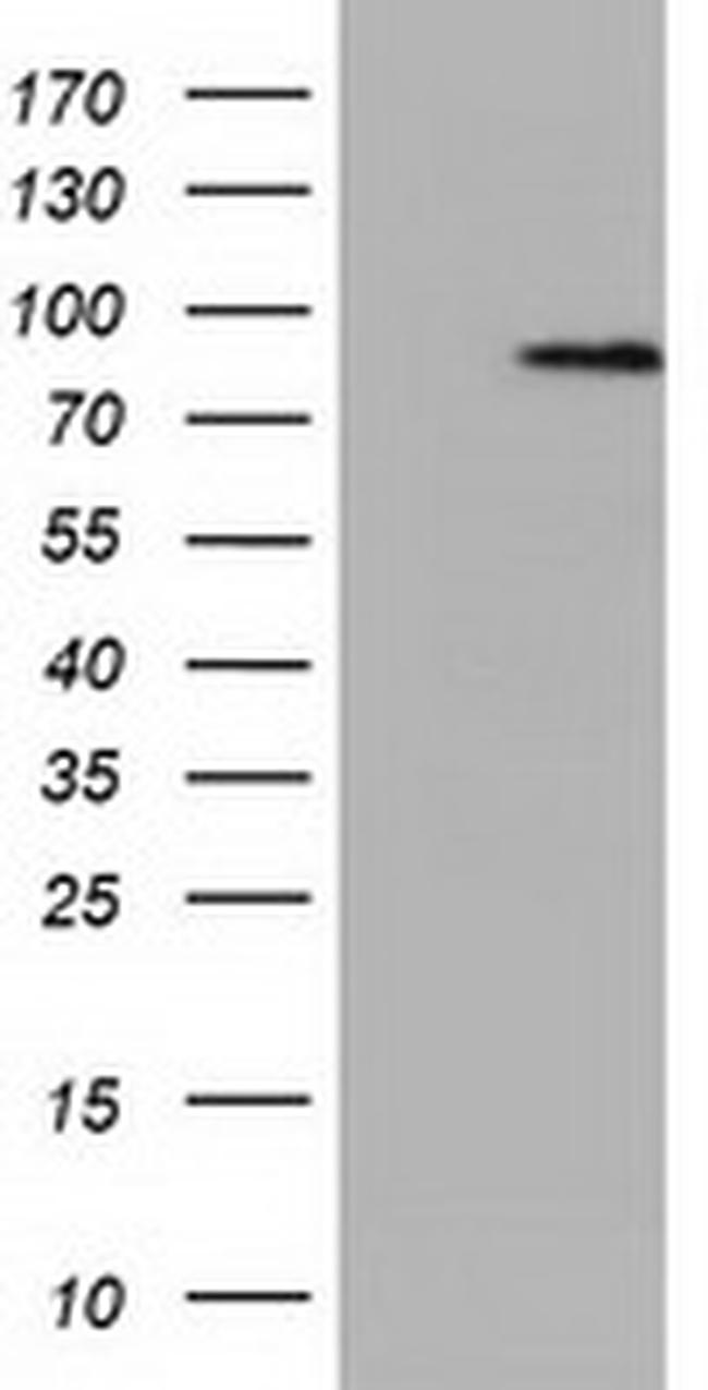 NEK11 Antibody in Western Blot (WB)