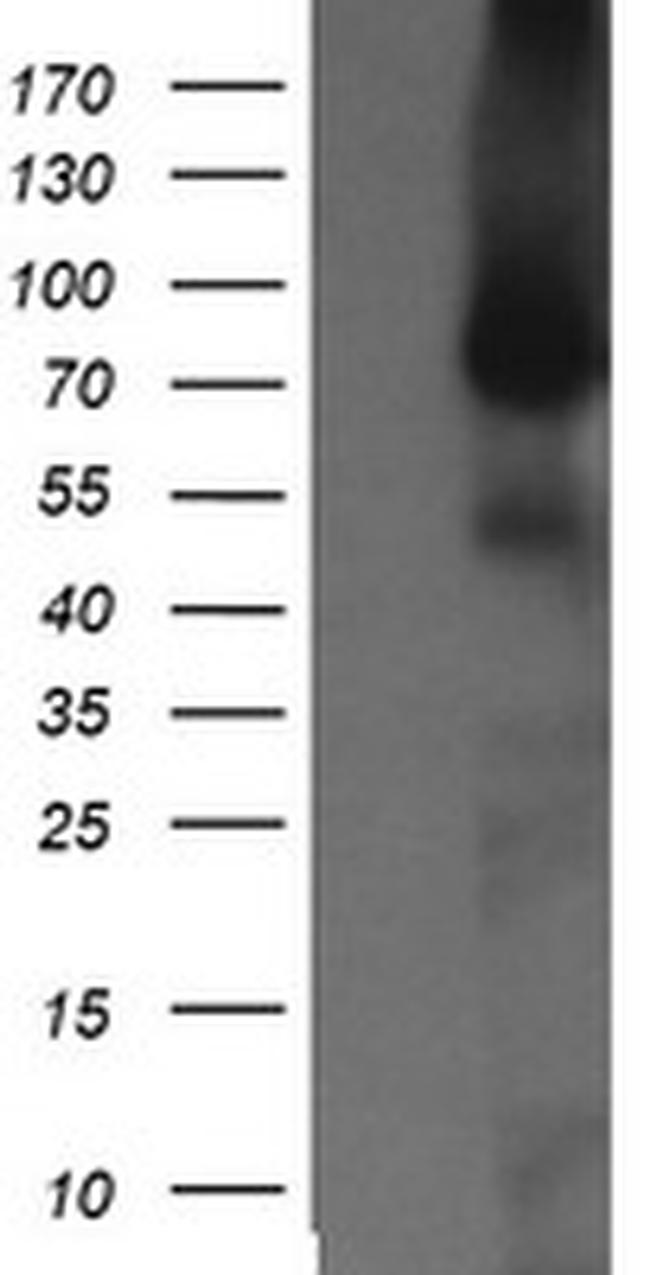 NEK11 Antibody in Western Blot (WB)