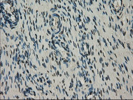 NEK6 Antibody in Immunohistochemistry (Paraffin) (IHC (P))