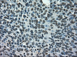 NEK6 Antibody in Immunohistochemistry (Paraffin) (IHC (P))