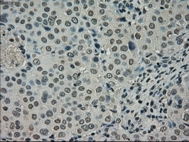 NEK6 Antibody in Immunohistochemistry (Paraffin) (IHC (P))