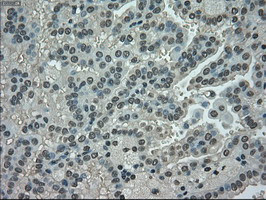 NEK6 Antibody in Immunohistochemistry (Paraffin) (IHC (P))