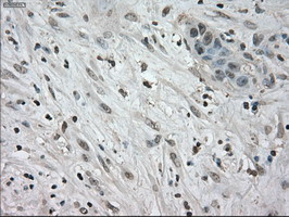 NEK6 Antibody in Immunohistochemistry (Paraffin) (IHC (P))