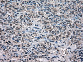 NEK6 Antibody in Immunohistochemistry (Paraffin) (IHC (P))