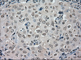 NEK6 Antibody in Immunohistochemistry (Paraffin) (IHC (P))