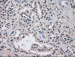 NEK6 Antibody in Immunohistochemistry (Paraffin) (IHC (P))