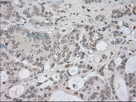 NEK6 Antibody in Immunohistochemistry (Paraffin) (IHC (P))