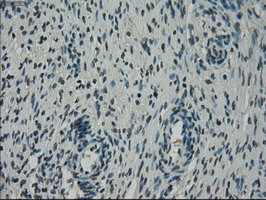 NEK6 Antibody in Immunohistochemistry (Paraffin) (IHC (P))