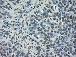 NEK6 Antibody in Immunohistochemistry (Paraffin) (IHC (P))