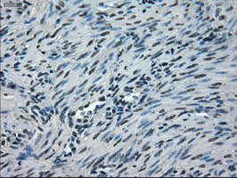 NEK6 Antibody in Immunohistochemistry (Paraffin) (IHC (P))