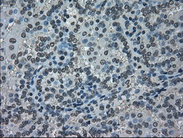 NEK6 Antibody in Immunohistochemistry (Paraffin) (IHC (P))