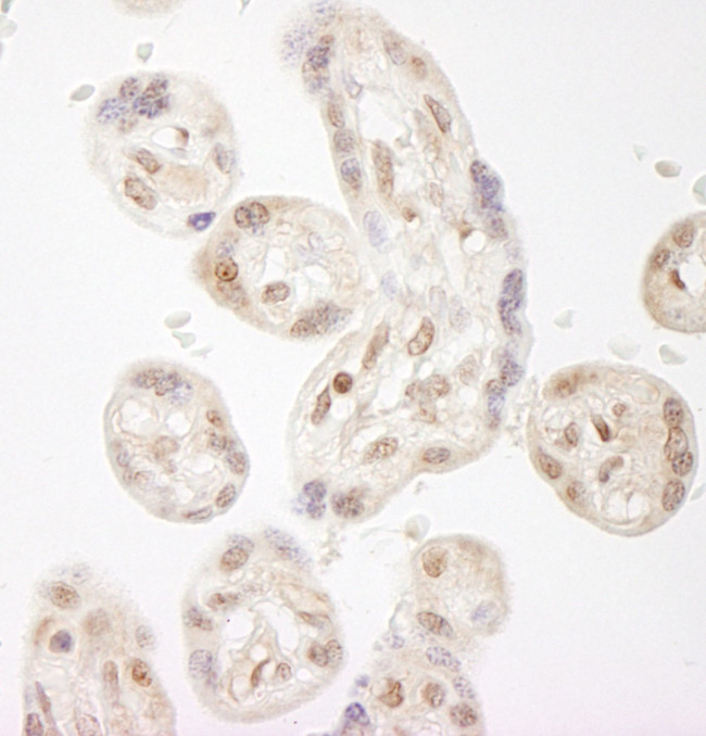 NELFA Antibody in Immunohistochemistry (IHC)