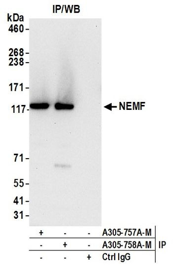 NEMF Antibody in Immunoprecipitation (IP)