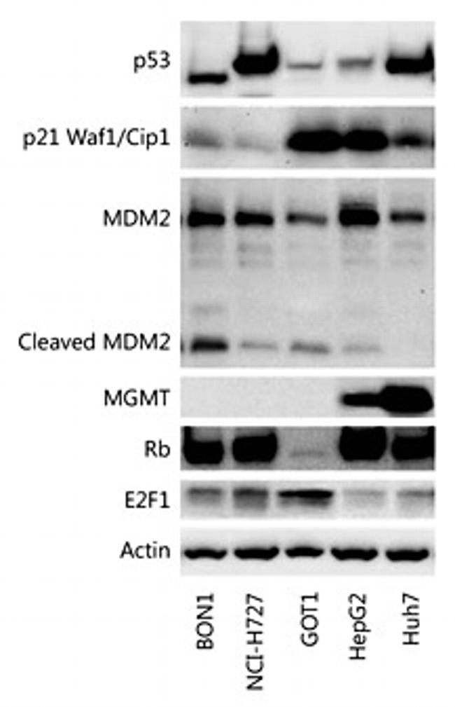 MDM2 Antibody in Western Blot (WB)