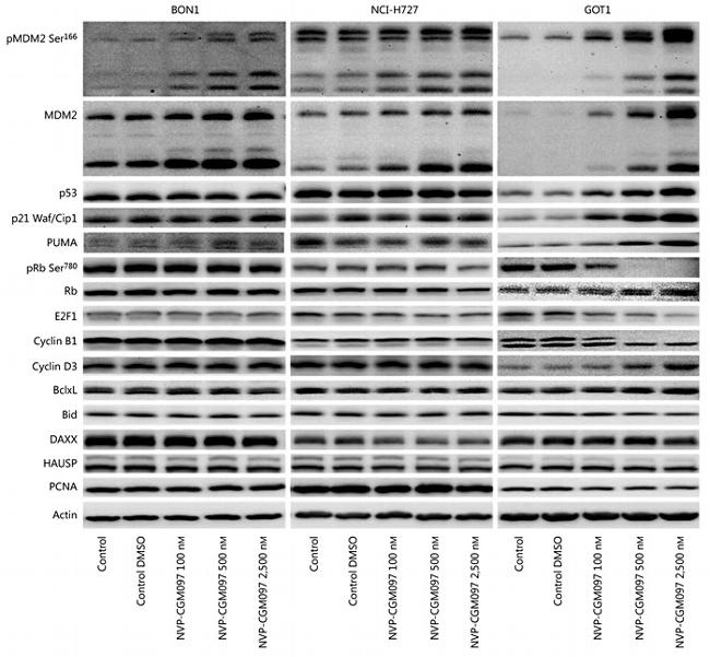 MDM2 Antibody in Western Blot (WB)