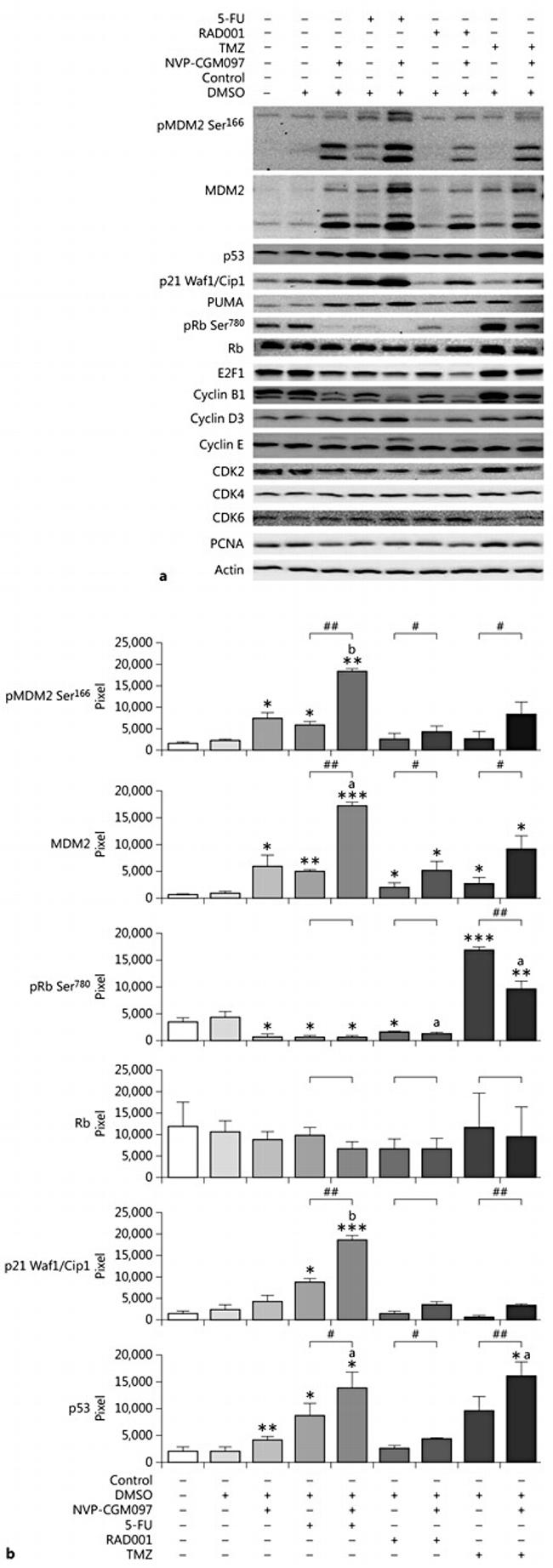 MDM2 Antibody in Western Blot (WB)