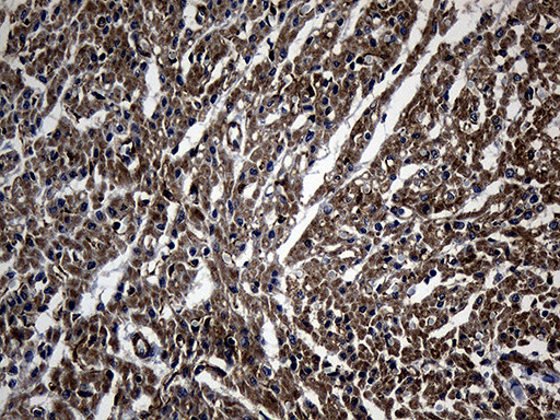 NES Antibody in Immunohistochemistry (Paraffin) (IHC (P))