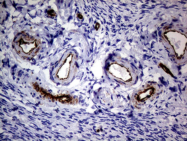 NES Antibody in Immunohistochemistry (Paraffin) (IHC (P))