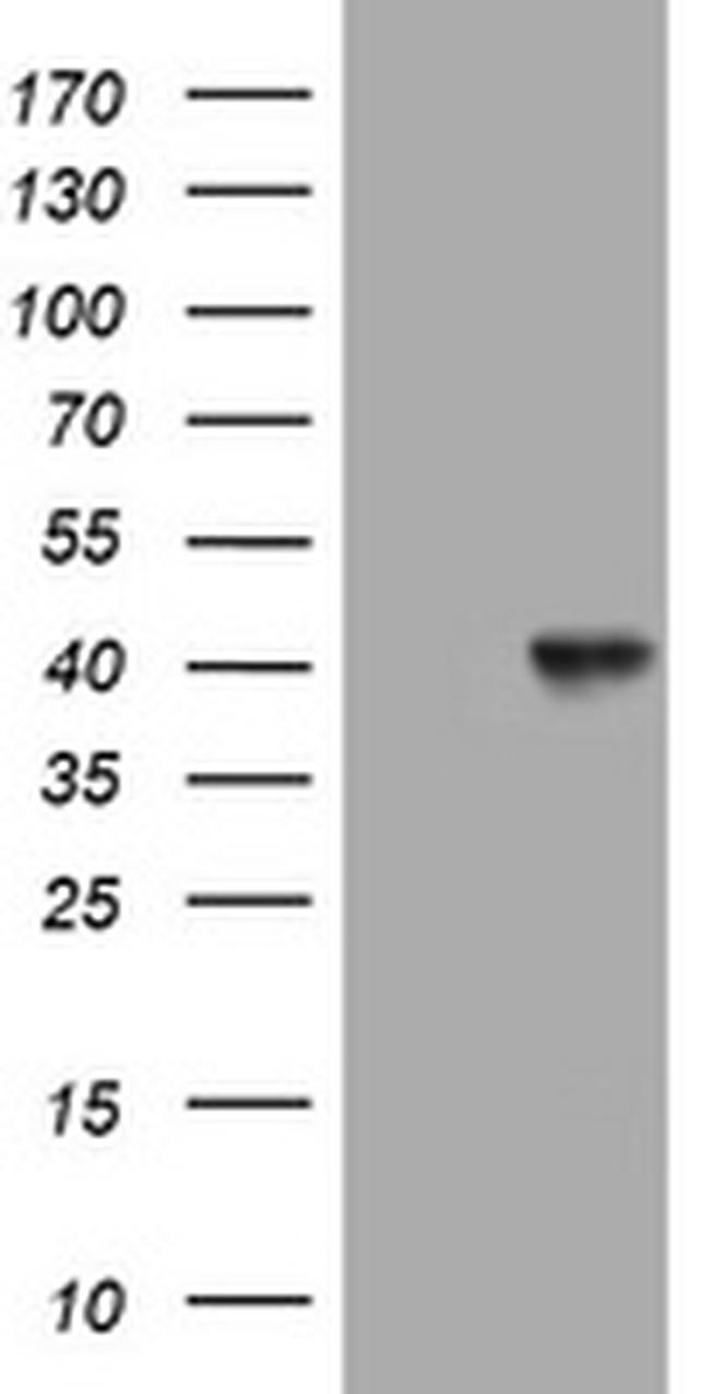 NEU1 Antibody in Western Blot (WB)