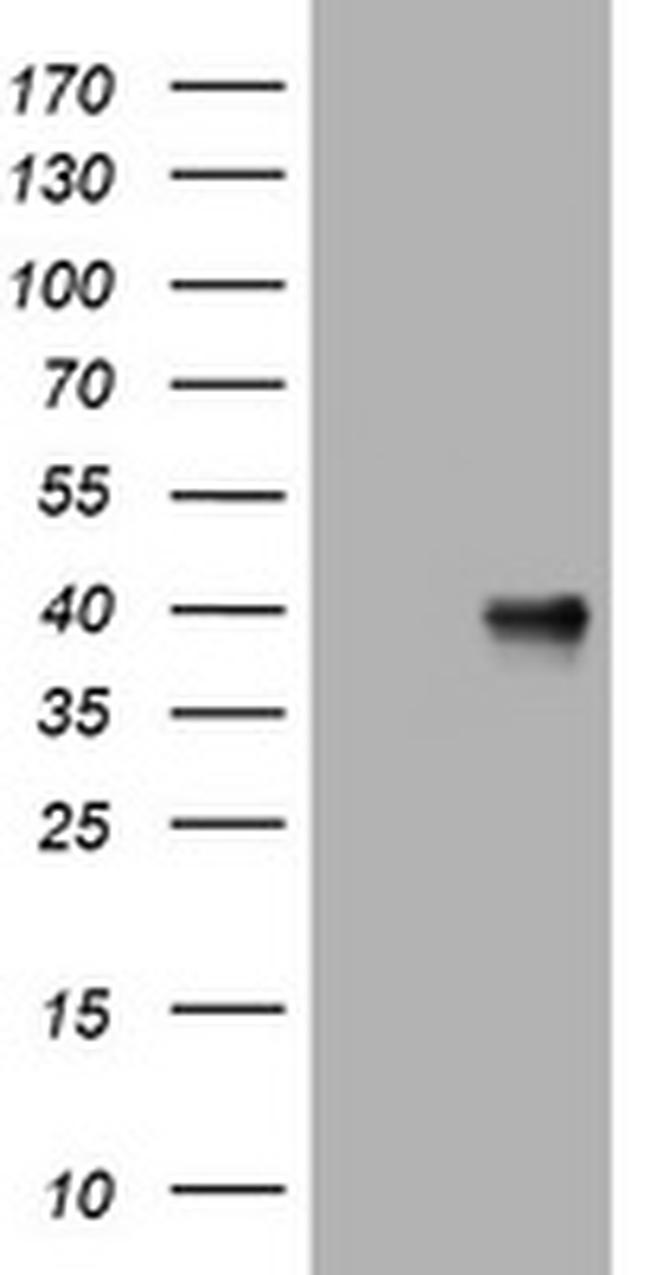 NEU1 Antibody in Western Blot (WB)