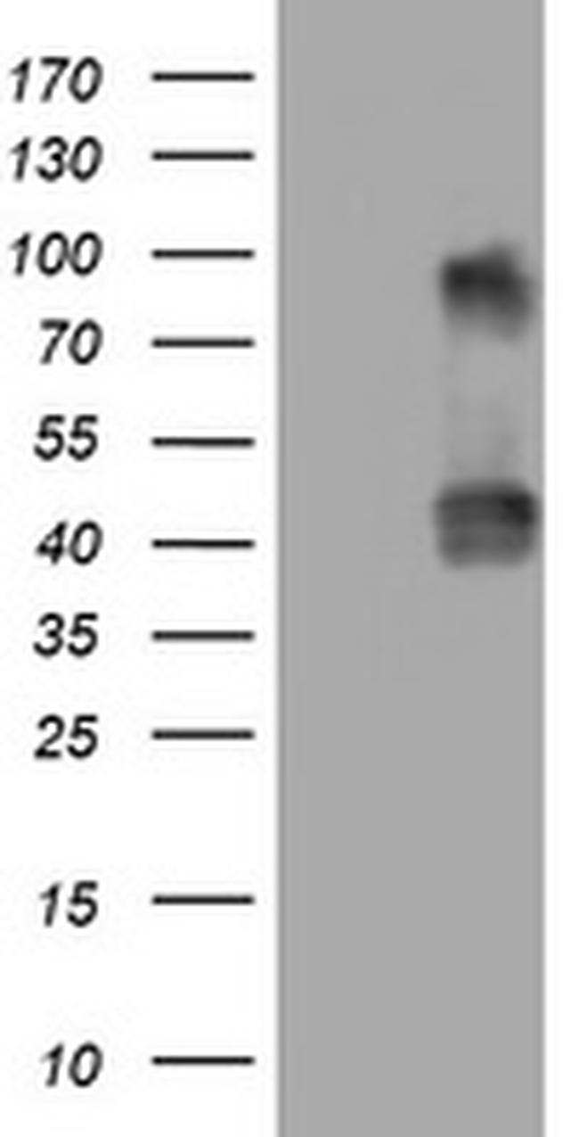 NEU1 Antibody in Western Blot (WB)