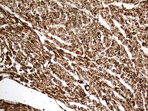 NF Antibody in Immunohistochemistry (Paraffin) (IHC (P))