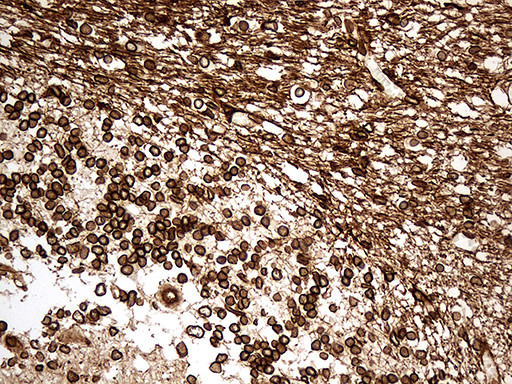 NF Antibody in Immunohistochemistry (Paraffin) (IHC (P))