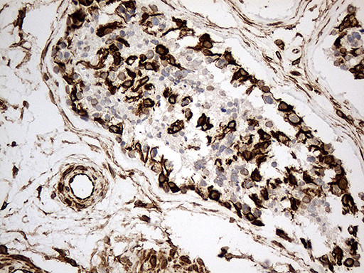 NF Antibody in Immunohistochemistry (Paraffin) (IHC (P))