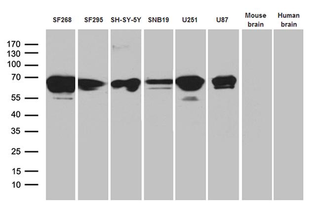 NF Antibody in Western Blot (WB)