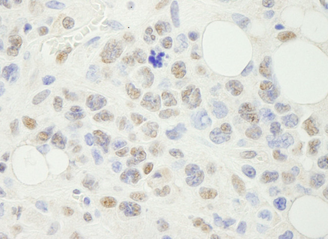 NF-YA Antibody in Immunohistochemistry (IHC)