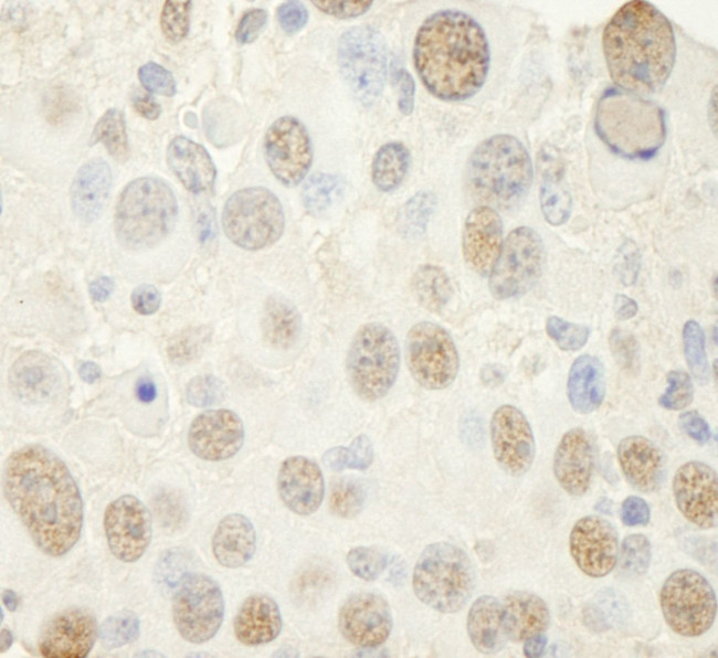 NF-YC Antibody in Immunohistochemistry (IHC)