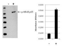 Human NFkB p65 (Phospho) [pS536] InstantOne™ ELISA Kit