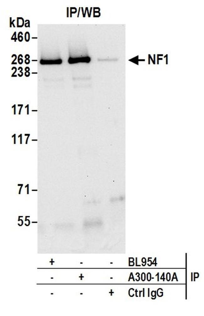 NF1 Antibody in Western Blot (WB)