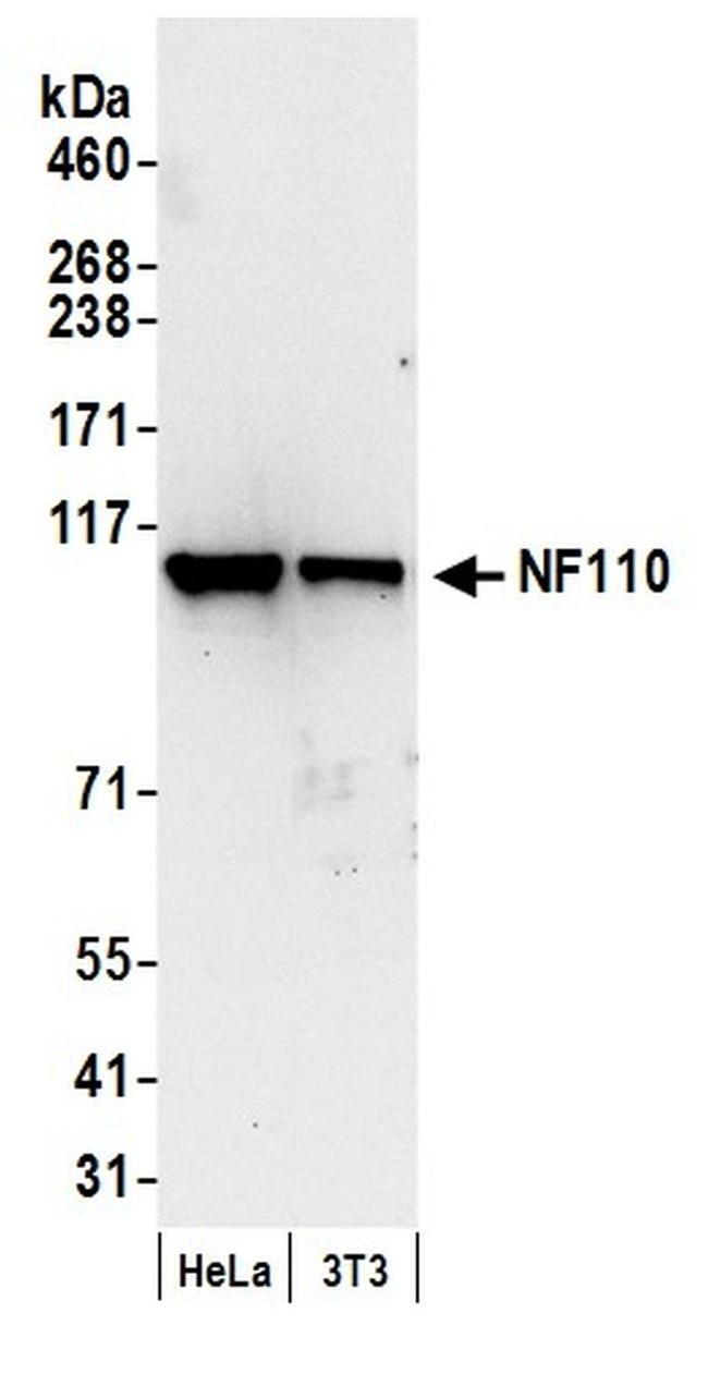 NF110 Antibody in Western Blot (WB)