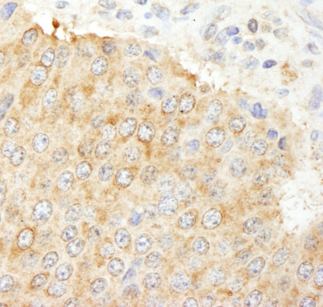 NF2 Antibody in Immunohistochemistry (IHC)