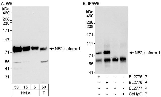 NF2 Antibody in Western Blot (WB)