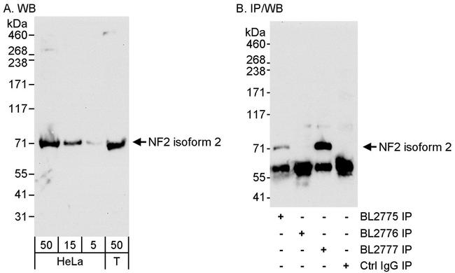 NF2 Antibody in Western Blot (WB)