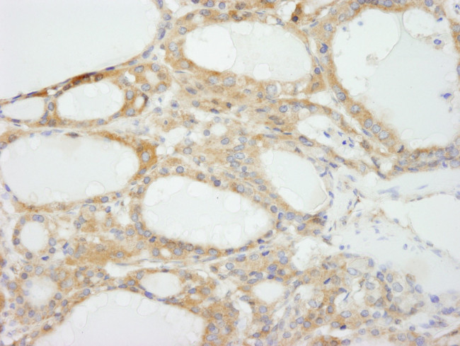 NF2 Antibody in Immunohistochemistry (IHC)