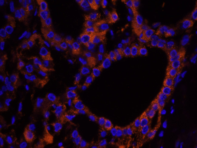 NF2 Antibody in Immunohistochemistry (IHC)