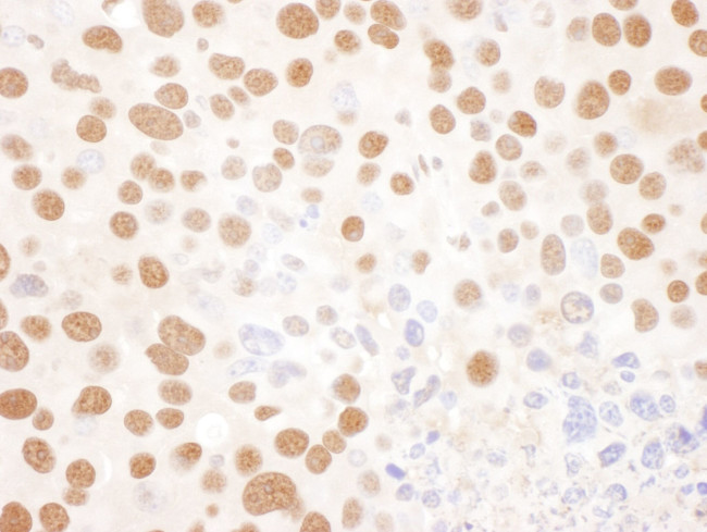 NF45 Antibody in Immunohistochemistry (IHC)