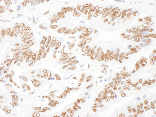 NF45 Antibody in Immunohistochemistry (IHC)