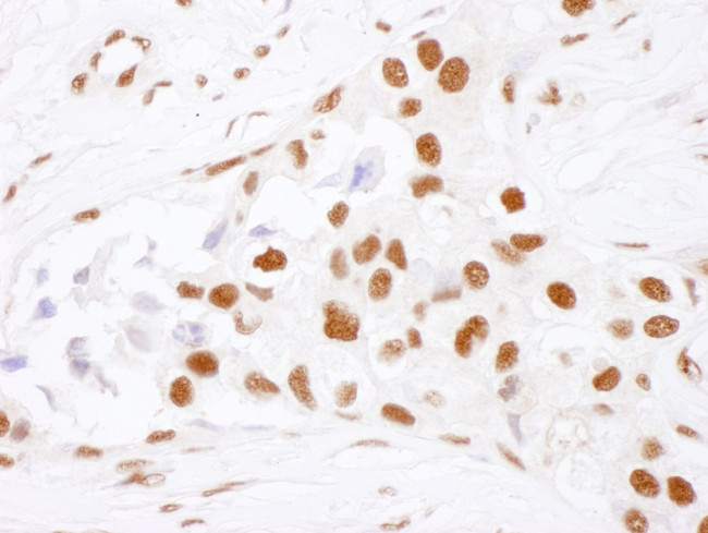 NF90 Antibody in Immunohistochemistry (IHC)