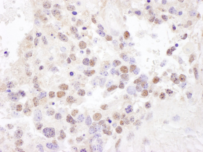 NF90/NF110 Antibody in Immunohistochemistry (IHC)