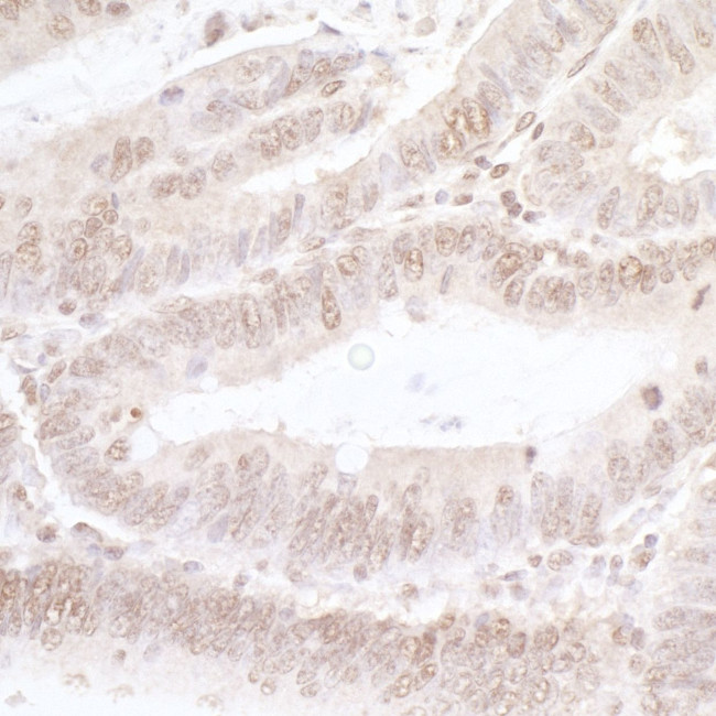 NFAT3 Antibody in Immunohistochemistry (IHC)