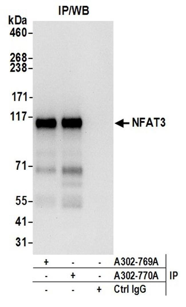 NFAT3 Antibody in Western Blot (WB)