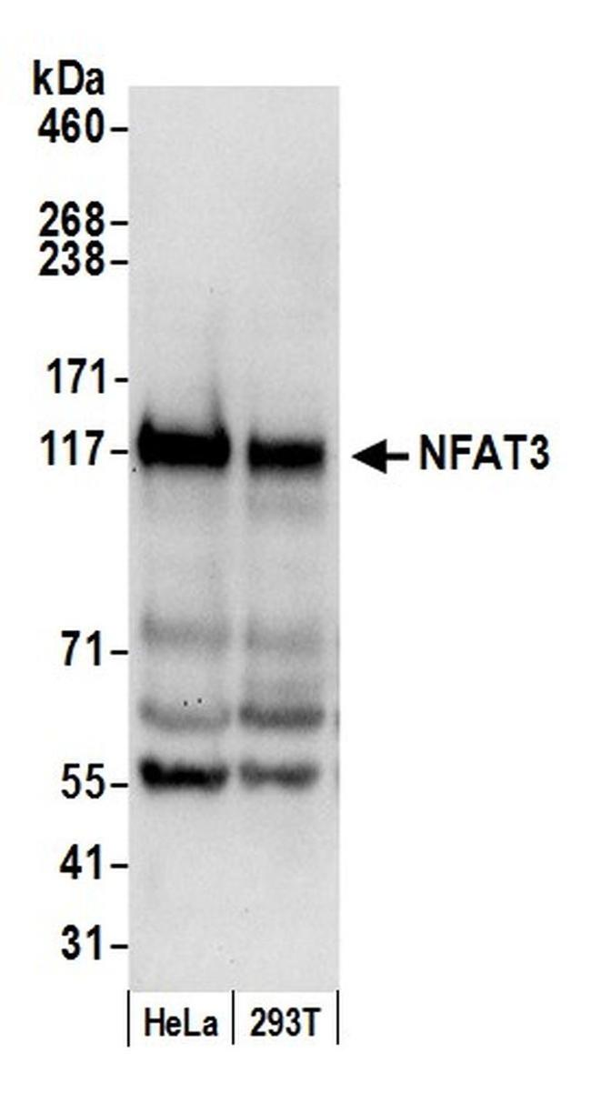 NFAT3 Antibody in Western Blot (WB)